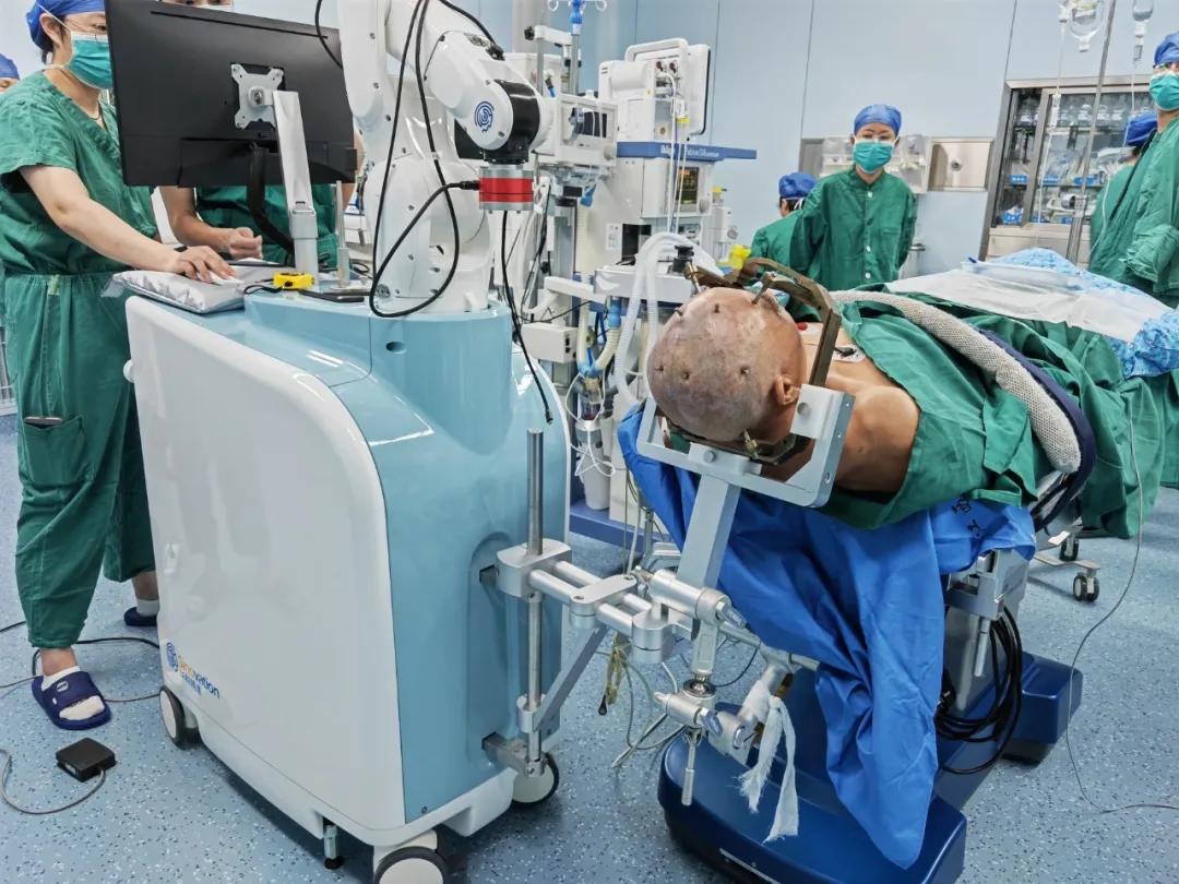 脑深部电刺激技术,中国首例脑深部电刺激手术