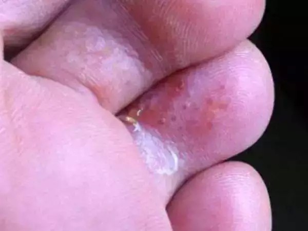 踩上去像云一样软的拖鞋,超级舒服踩在云端的拖鞋