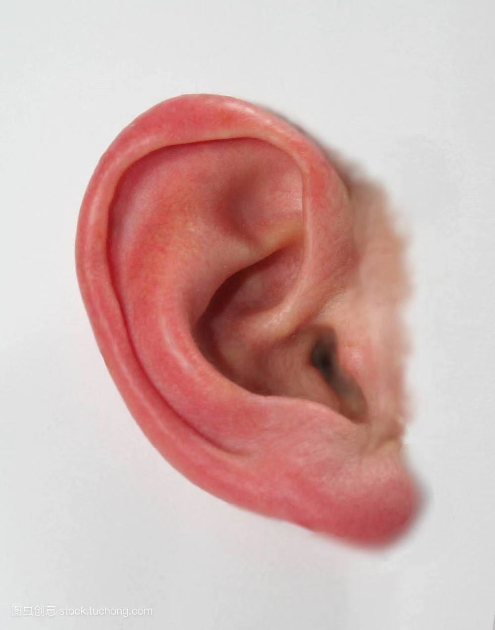 耳朵软骨畸形能矫正吗,新生儿耳朵畸形矫正费用大概多少