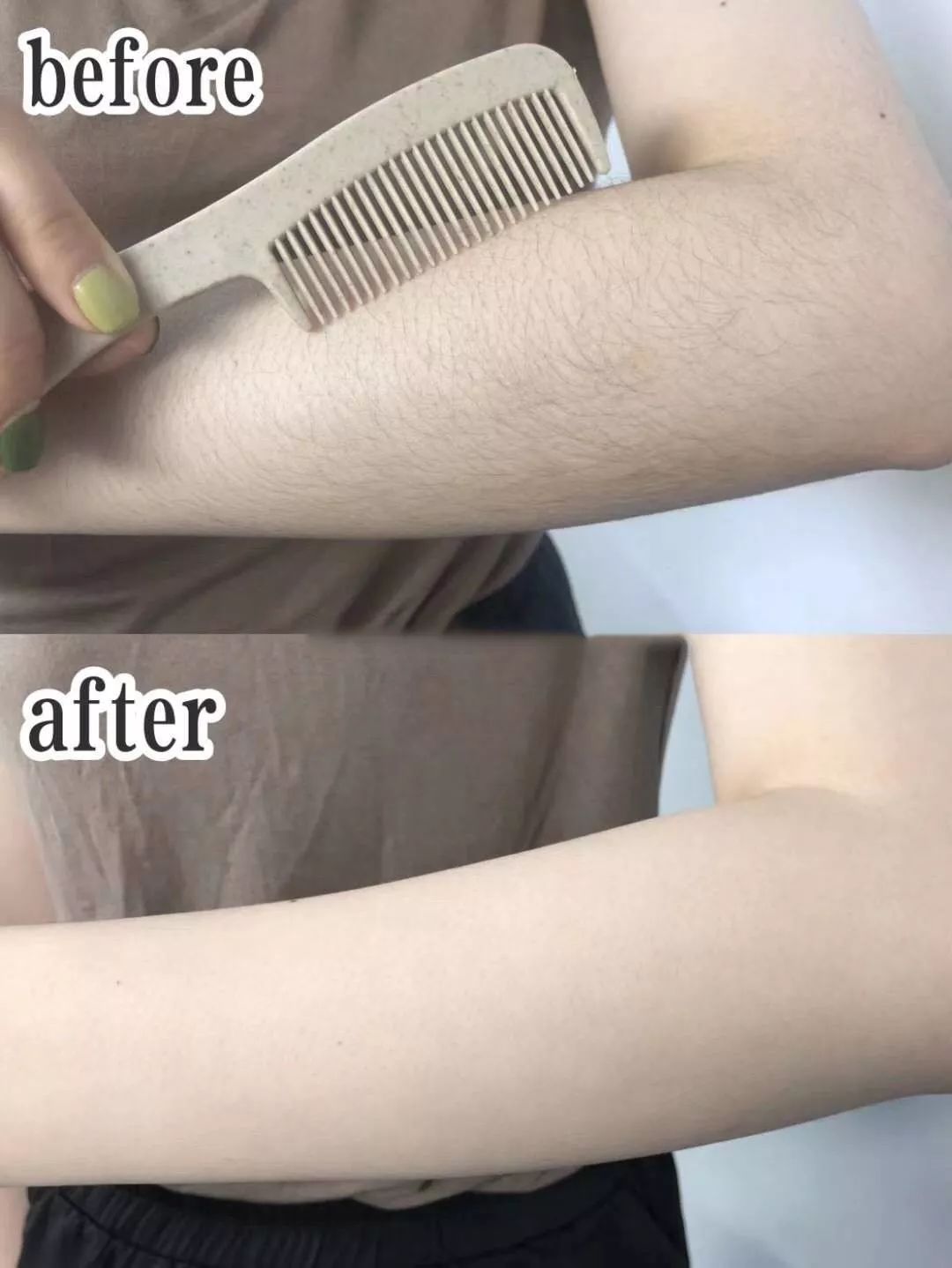 脱毛的方法不花钱,脱毛小技巧立马见效