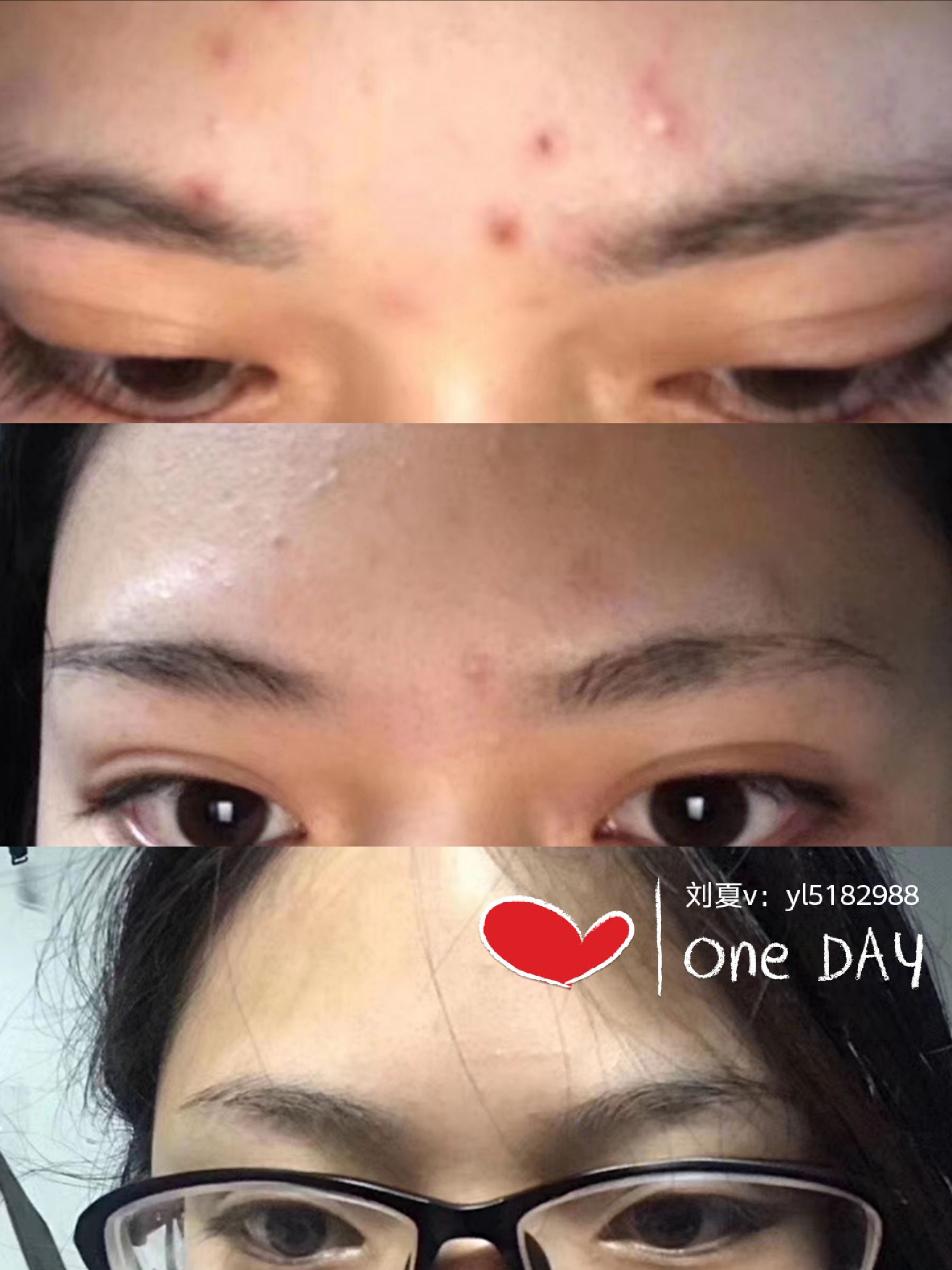 祛斑美肤最有效的滋养霜