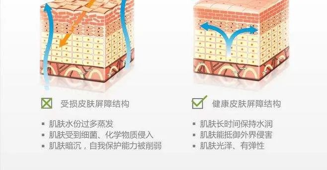 脸一换季就过敏怎么办,换季脸部过敏最快的补救方法