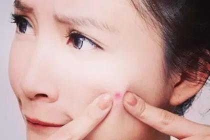 快来月经时下巴长包怎么回事,快来月经下巴下颚老是长痘