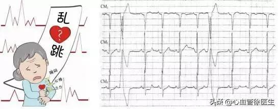 儿童心脏早搏是什么原因导致,导致心脏早搏的原因是什么