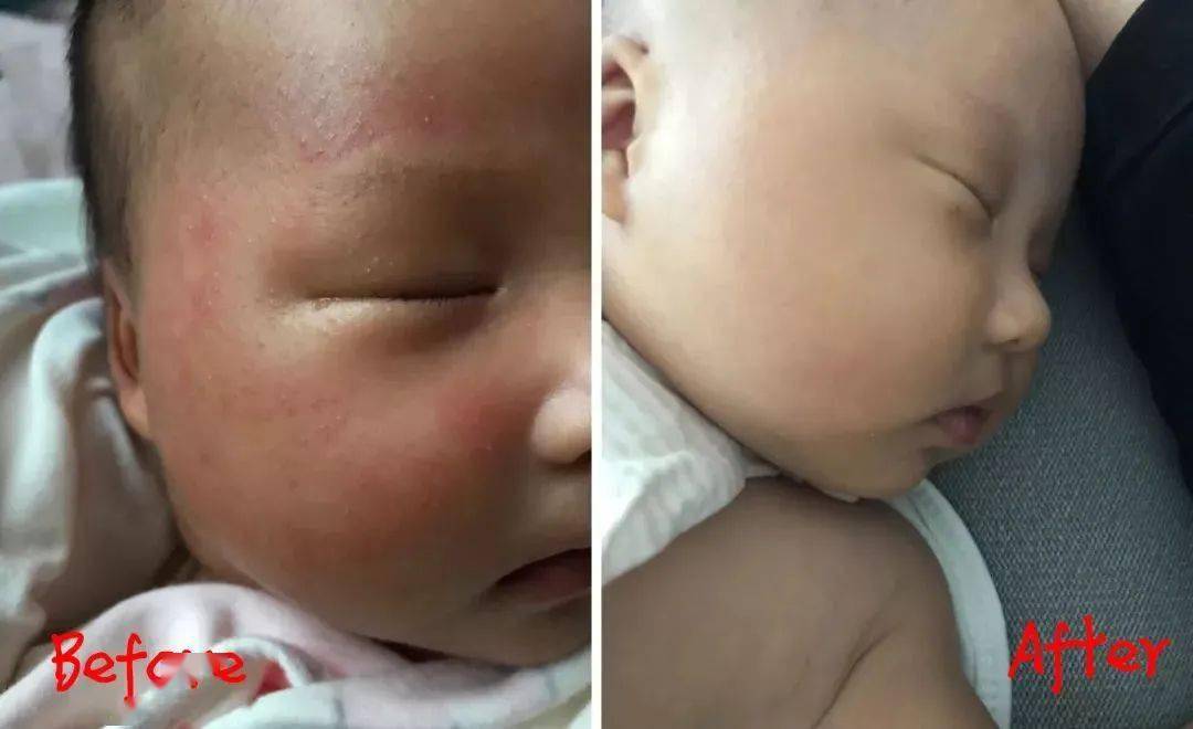 英国珀婷pertine除螨喷雾剂,瑞士珀婷pertine除螨喷雾剂