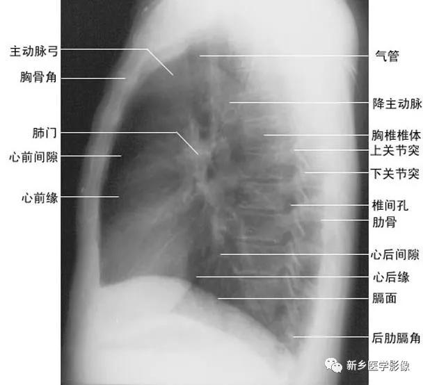 收藏：详细的胸部X线解剖，最基础最实用