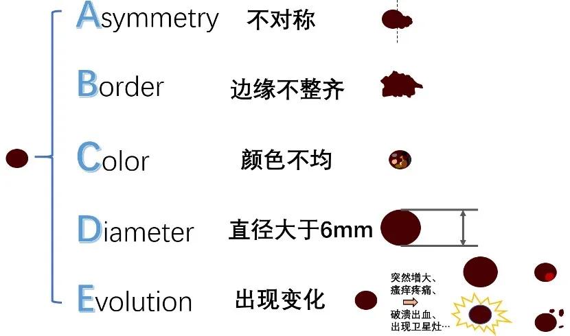 医生！我这颗痣要紧么？