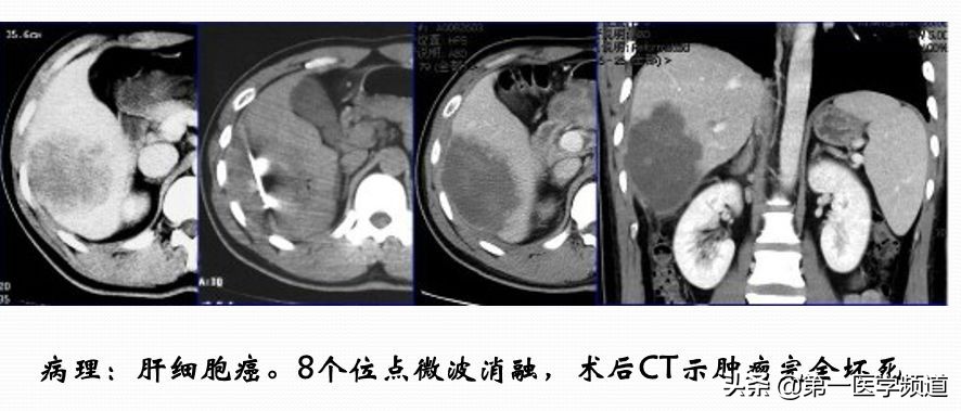 「医影传声」上海交通大学医学院附属瑞金医院卢湾分院放射科主任