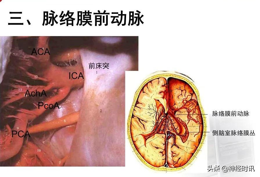 脑动脉解剖学讲解,基底节区脑血管解剖