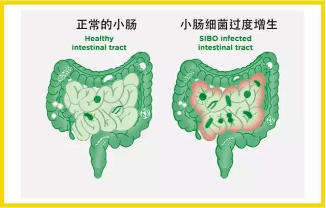 专家：糖尿病人切忌少食多餐，少食多餐会让胰岛素水平更糟糕！