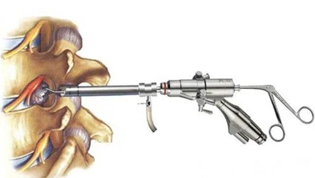 玉田县医院骨科,玉田县中医医院骨一科专家