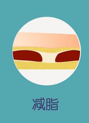 男性体脂20%是先减脂还是增肌,体脂在正常范围内要继续减脂吗