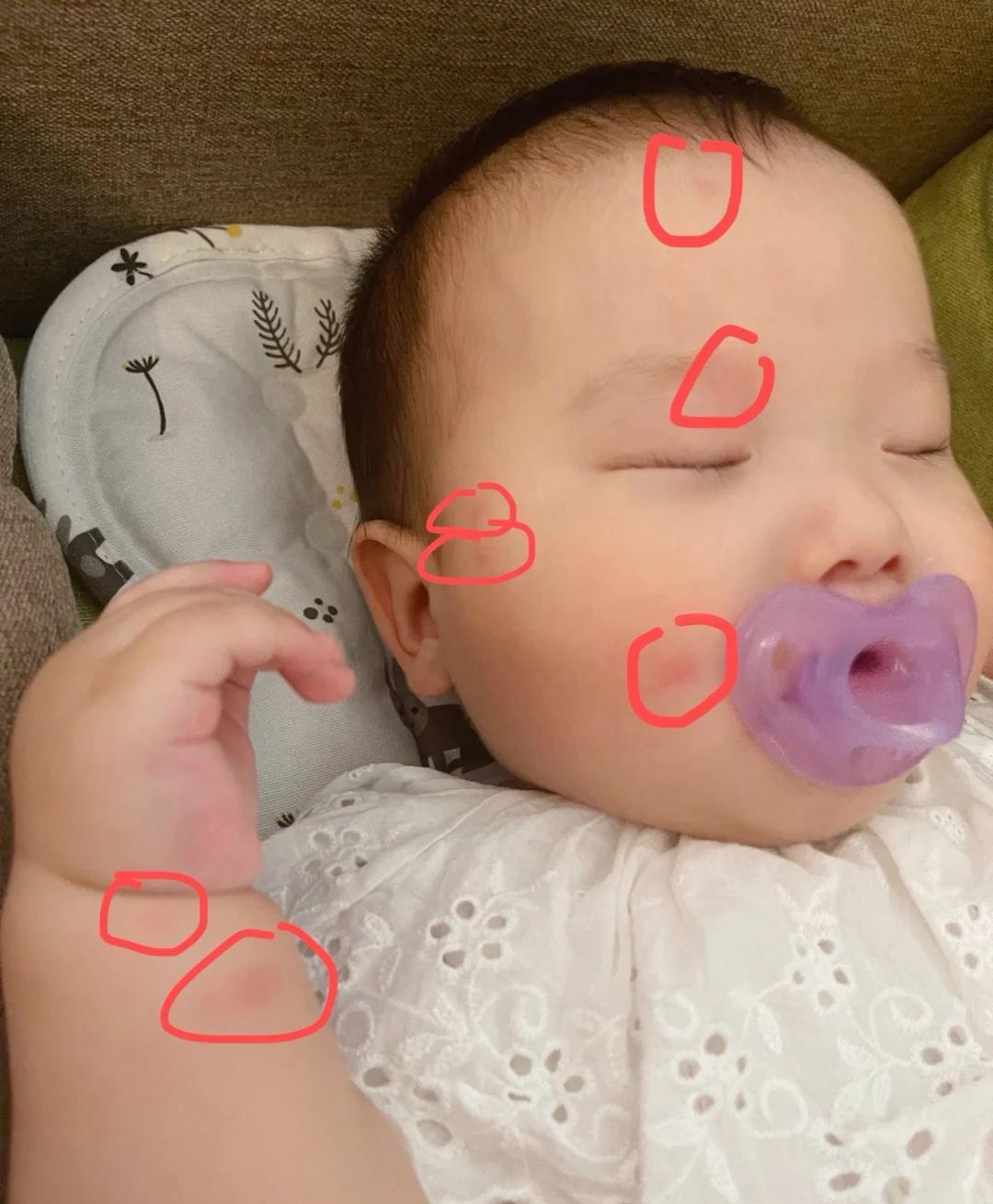 宝宝有蚊子咬搞什么驱蚊,宝宝总被蚊子咬怎么有效驱蚊