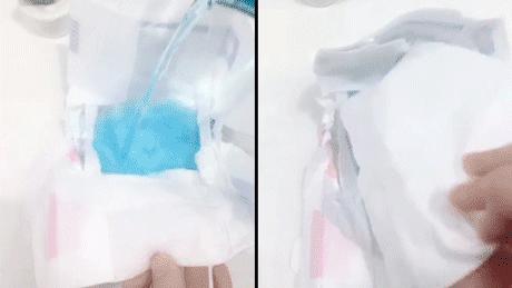 为什么宝宝尿不湿老漏尿到腰上,宝宝尿不湿为什么经常漏尿