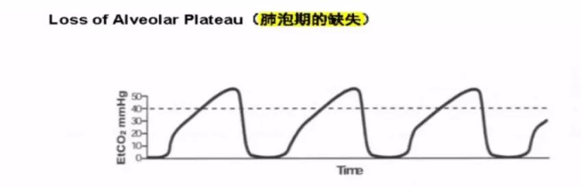 李娟教授：呼气末二氧化碳分压监测的临床应用