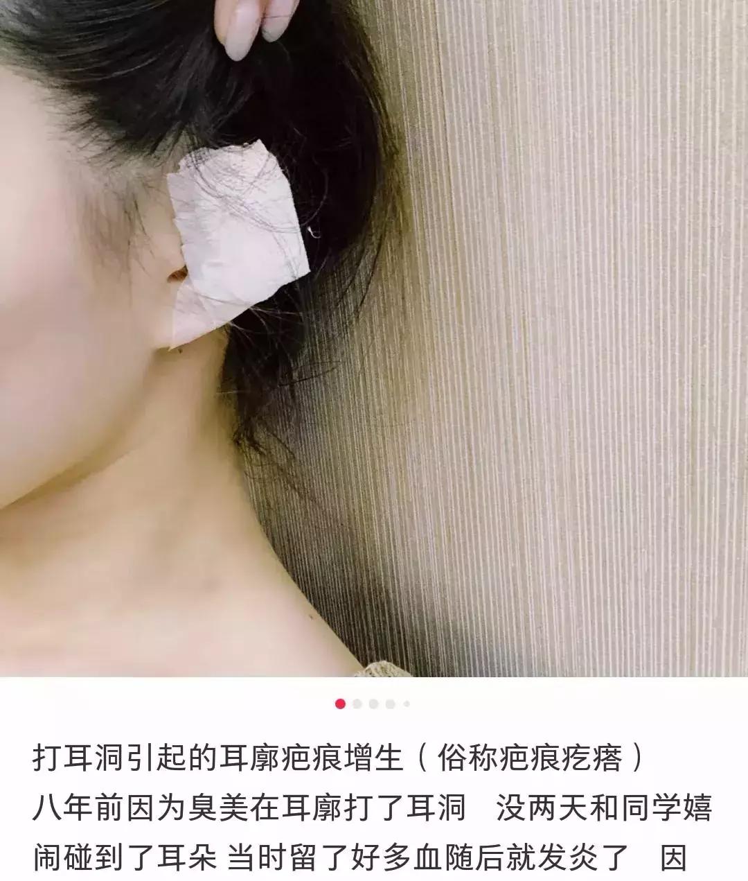 想打耳洞又怕打了不好看,想打耳洞但是怕耳洞长脏东西
