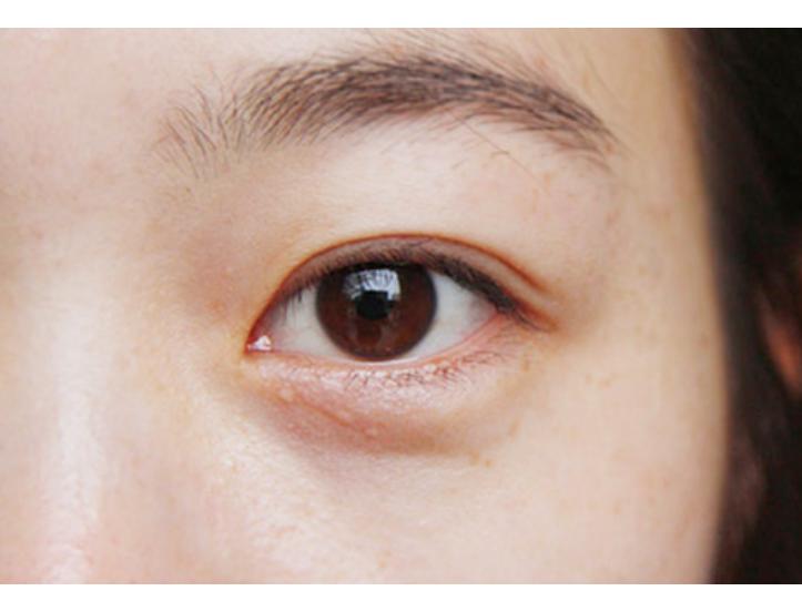 左眼眼皮一直跳动有什么征兆,眼皮一直跳预示什么疾病