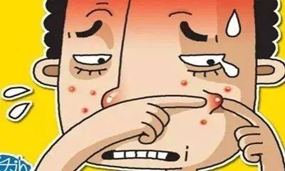 手脱皮止痒药膏,皮肤病手脱皮用什么药