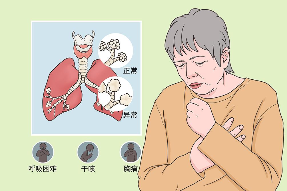 服用靶向药腹泻皮疹吃什么药好,靶向药引起腹泻中医治疗