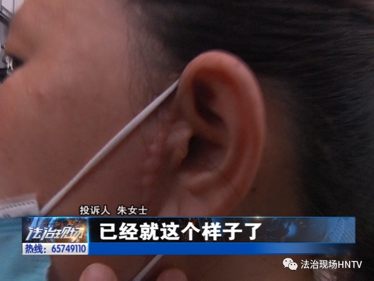 濂冲瓙鎷夌毊鎵嬫湳鍚庣暀澶氭潯浼ょ棔,娌冲崡閮戝窞濂冲瓙鎷夌毊鎵嬫湳