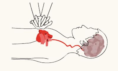 突然晕倒怎么办,上厕所突然晕倒