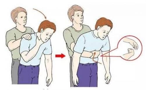 3岁小孩误吞一整颗花生怎么办,一岁宝宝误吞一颗花生米怎么办