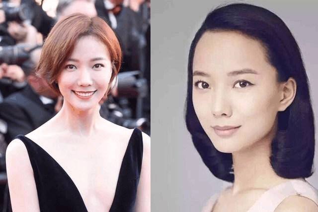 陈奕迅秃顶头发稀疏,陈奕迅同款发际线怎么补救