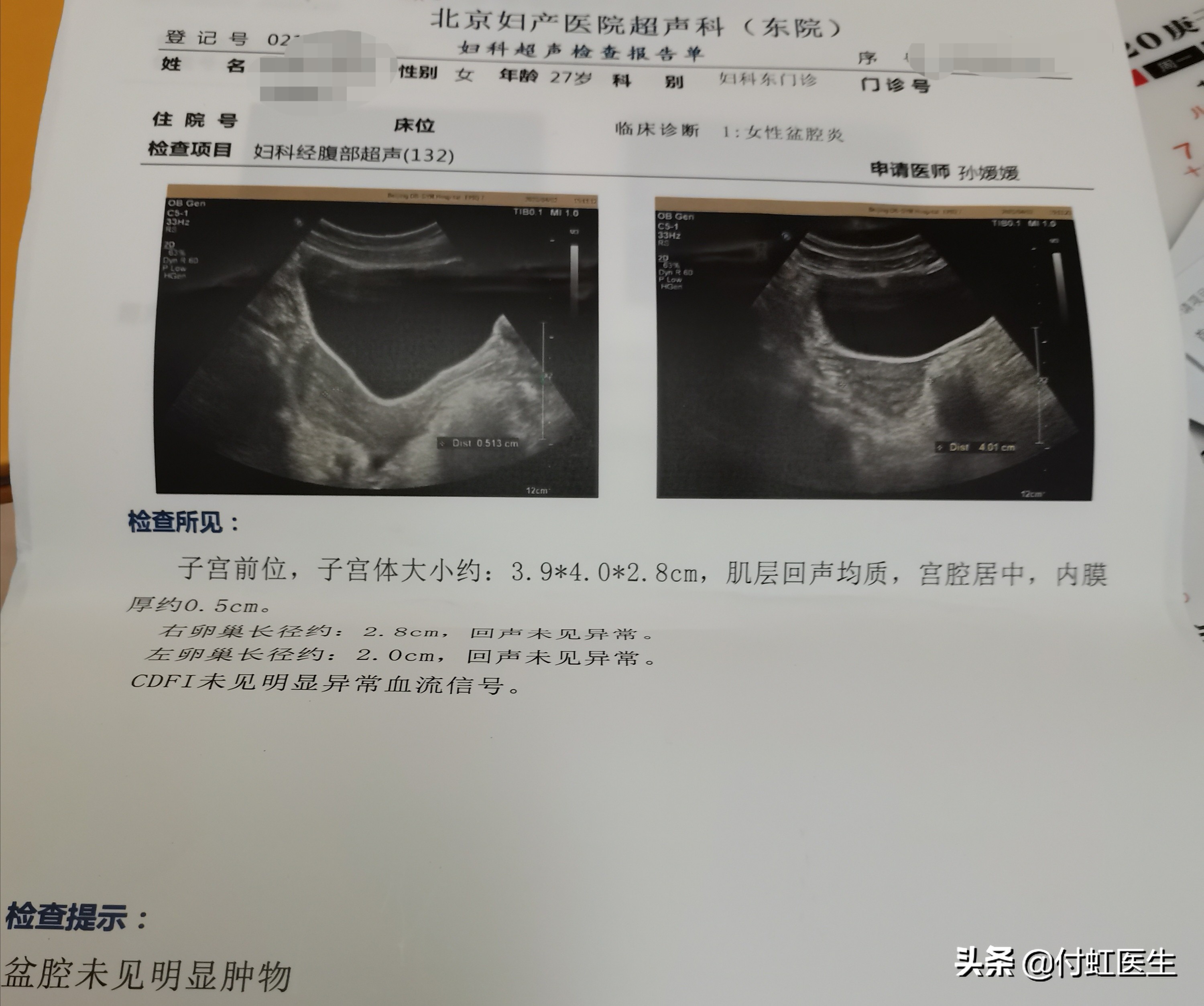 3次人流后去医院做什么检查,做了人流想再怀孕要去做什么检查