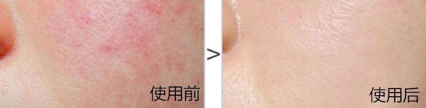 珂润跟片仔癀哪个好,片仔癀和珂润哪个好用