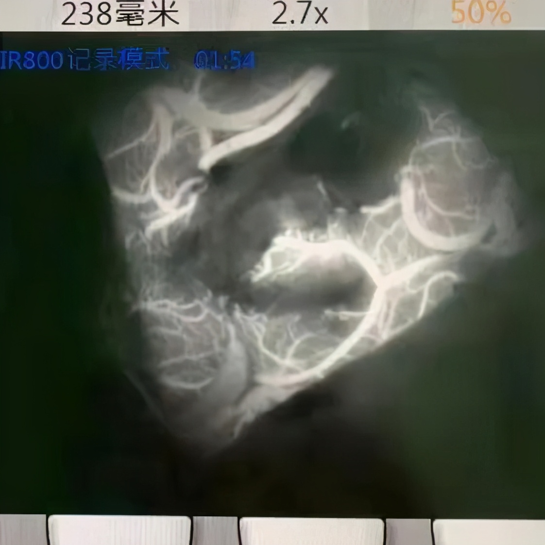 普洱市人民医院神经内科,思茅区人民医院神经外科