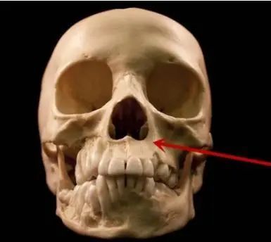 年纪轻轻法令纹和眼袋同时拥有,年纪轻轻法令纹和鱼尾纹就很重