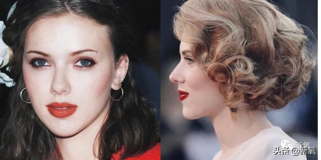 阔面脸轮廓怎么做,阔面脸怎么做医美