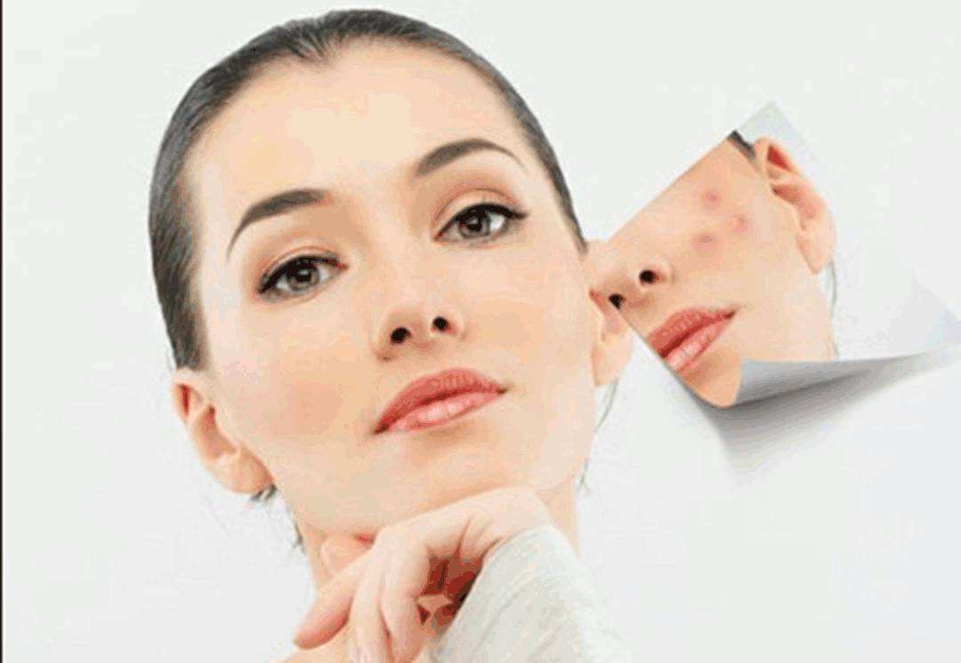 痘坑肌肤怎么刷酸,平滑肌肤的正确刷酸方法