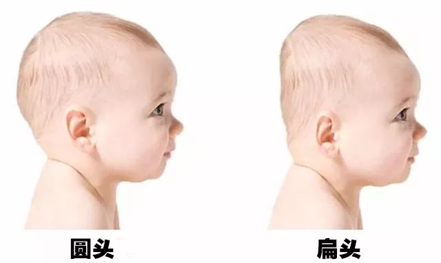 扎马尾后脑勺扁平简单,扎马尾前面扁平怎么弄