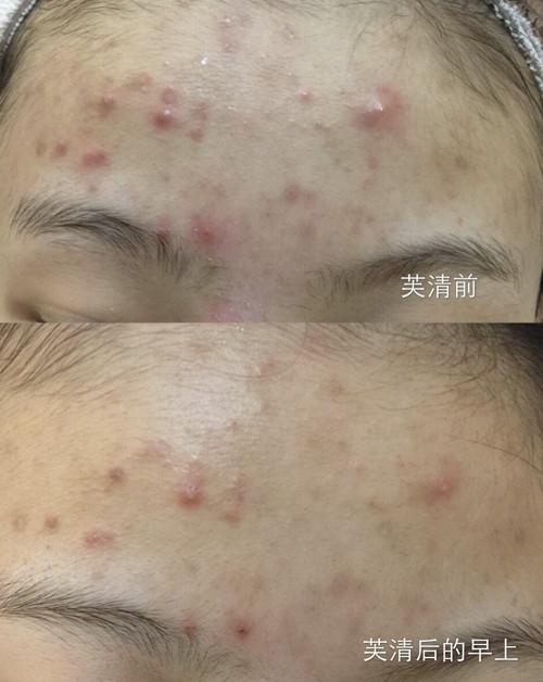 十大品牌美容面膜,医美面膜别乱用这几款无限回购