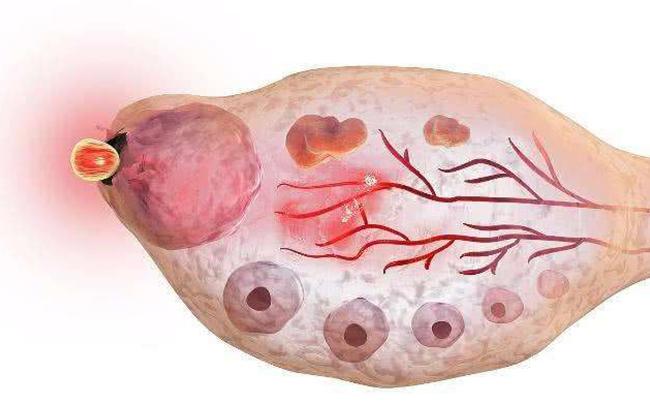 排卵期有拉丝分泌物是排卵吗,排卵期白带多是卵子质量好吗