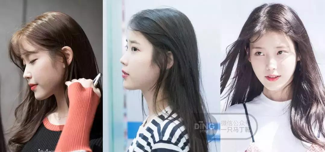 凹面型侧脸怎么改善,凹面型侧脸是怎么造成的