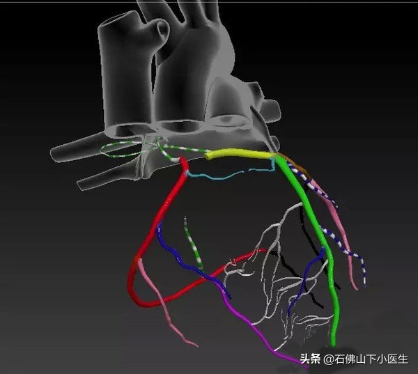 跟陈大夫学看冠脉，看一下人体的冠脉是怎么样的