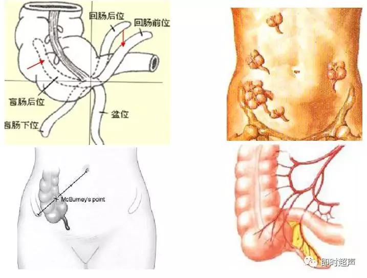 小儿消化道急症超声