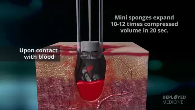 突破传统止血局限：美军战场止血利器X-stat
