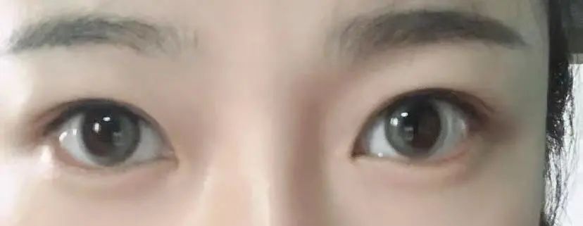 戴美瞳和不戴美瞳的区别 (戴美瞳会不会离不开美瞳)