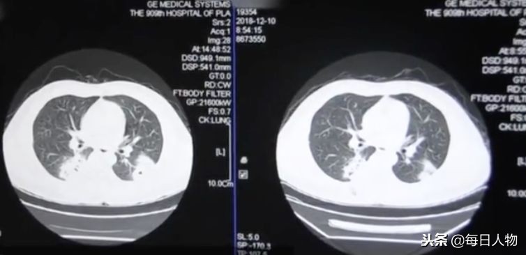 12岁男孩弑母案女孩讲述杀母过程,12岁男孩杀女童后续