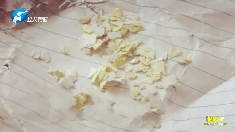 眼里不容“纸片”|郑州爱尔眼科医院屈光中心主任游昌涛博士科普来了