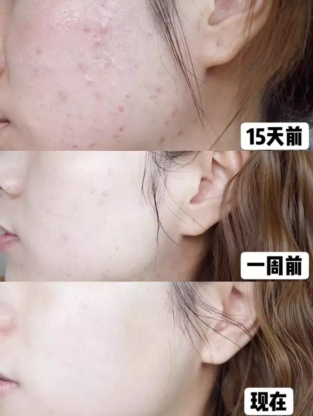 古力娜扎大额头妆容,古力娜扎万圣节