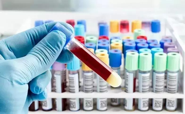 产妇42天复查宝宝也得复查吗,医院42天复查都复查什么