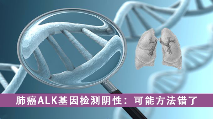 大便基因检测阴性可排除肠癌吗,检测肿瘤标志物注意事项