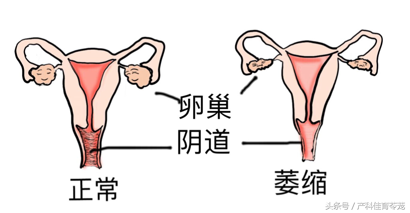 妇女外阴痒干涩用什么药膏,老年人外阴瘙痒干涩咋办