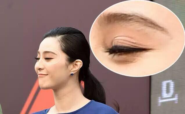李小璐双眼皮褶,被美颜坑惨的明星