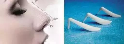 选哪种硅胶隆鼻既经济又实惠,现在都用什么形状的硅胶隆鼻