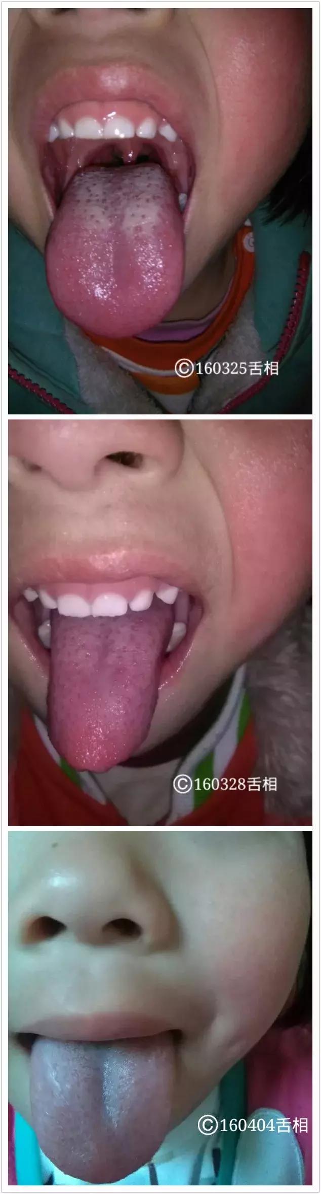 孩子脚冷冒汗,孩子脚发凉出虚汗怎么回事